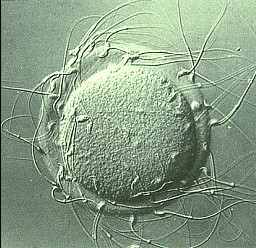 Fig.1 – Spermatozoi che circondano una cellula uovo per fecondarla - Fecondazione