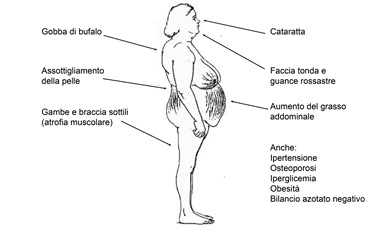 Fig.1 – Manifestazioni cliniche della sindrome di Cushing - farmaci cortisonici