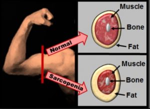 Invecchiamento e sarcopenia